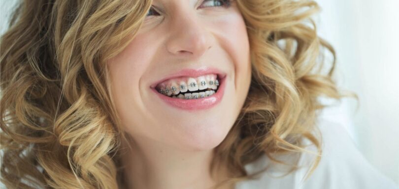 orthodontic treatment