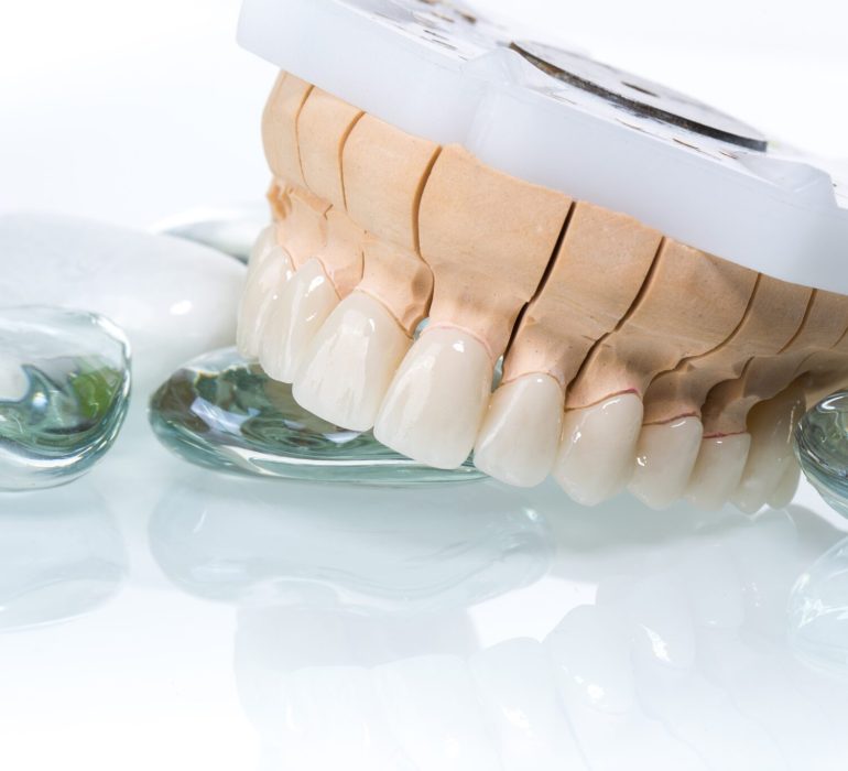 zirconia crown dental