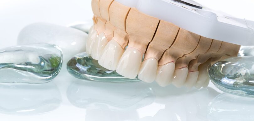 zirconia crown dental