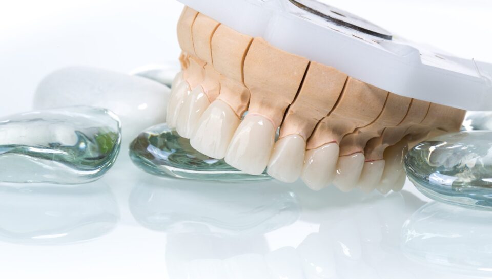 zirconia crown dental