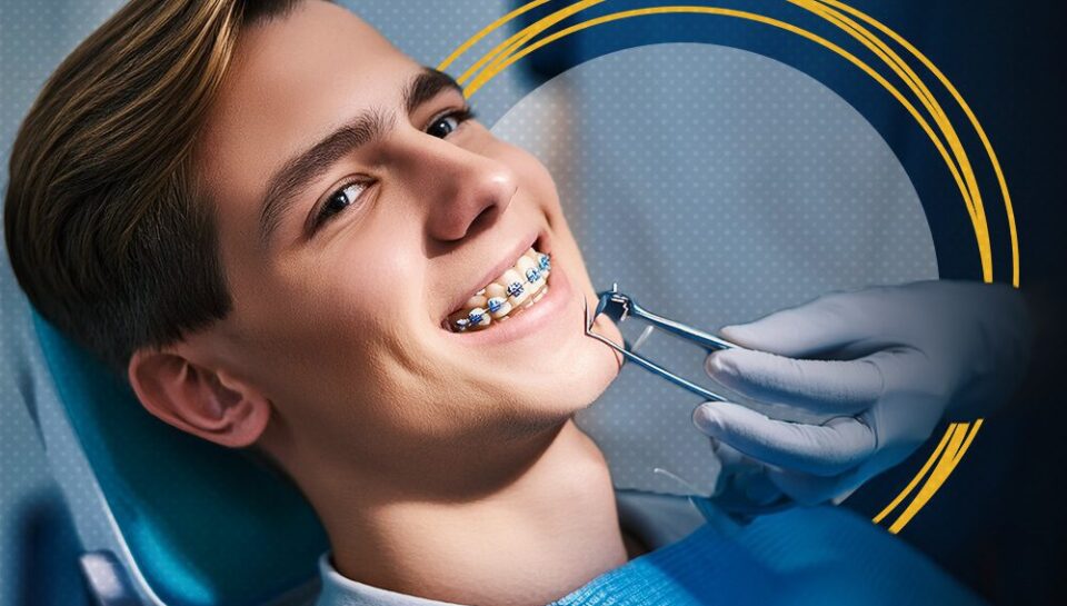 braces extraction