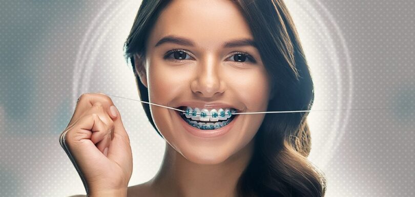 how to floss with braces with floss threaders