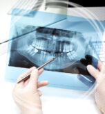 signs of dental bone graft failure