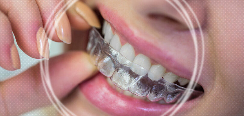 how long does invisalign treatment take