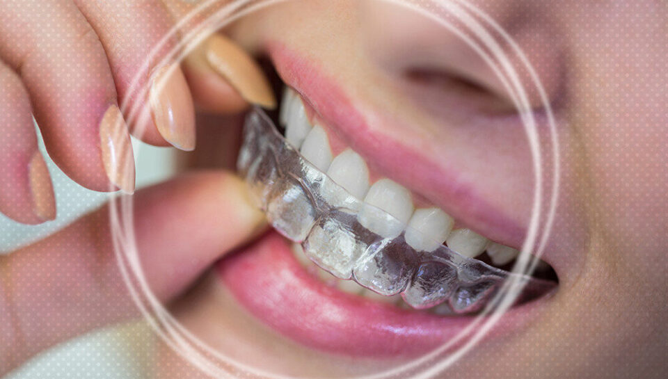 how long does invisalign treatment take