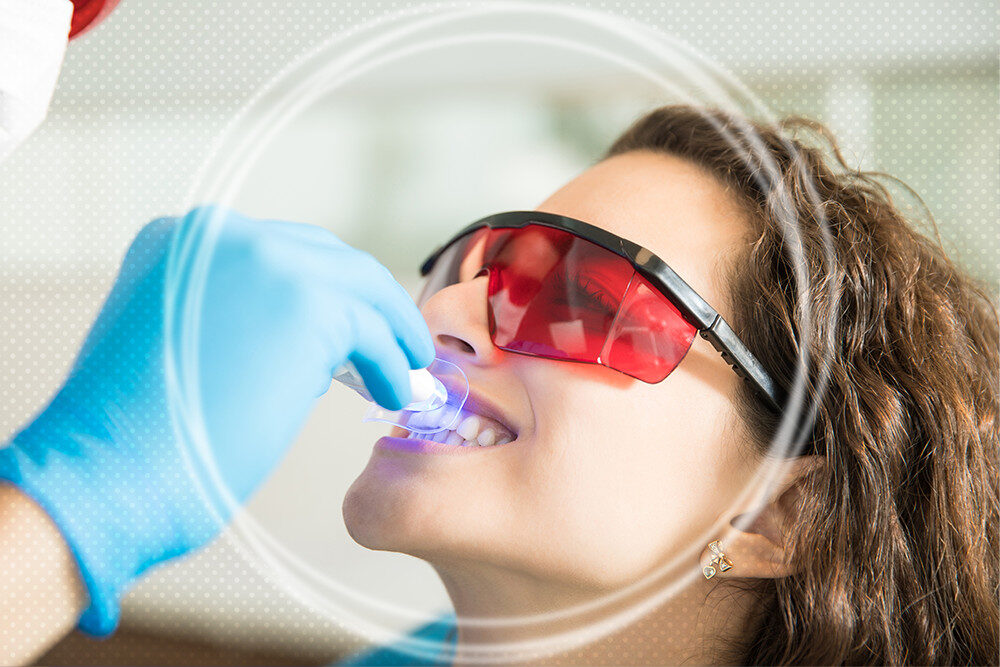 How often can I get my teeth cleaned?