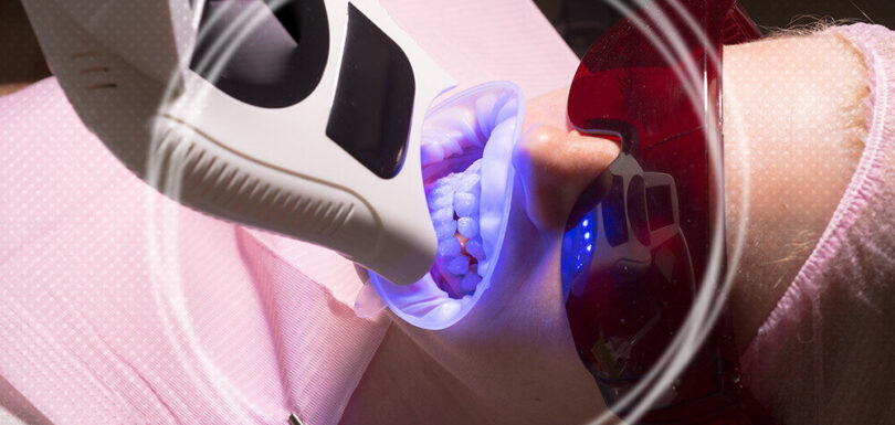 Most Common Laser teeth cleaning side effects