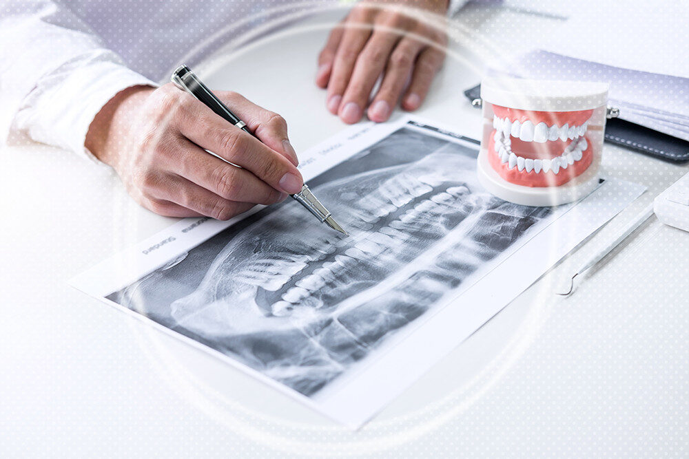 7 Bone Graft Rejection Symptoms and How to Avoid It?