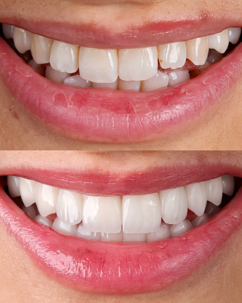 A patient receiving professional dental scaling and routine oral hygiene care at a top rated clinic