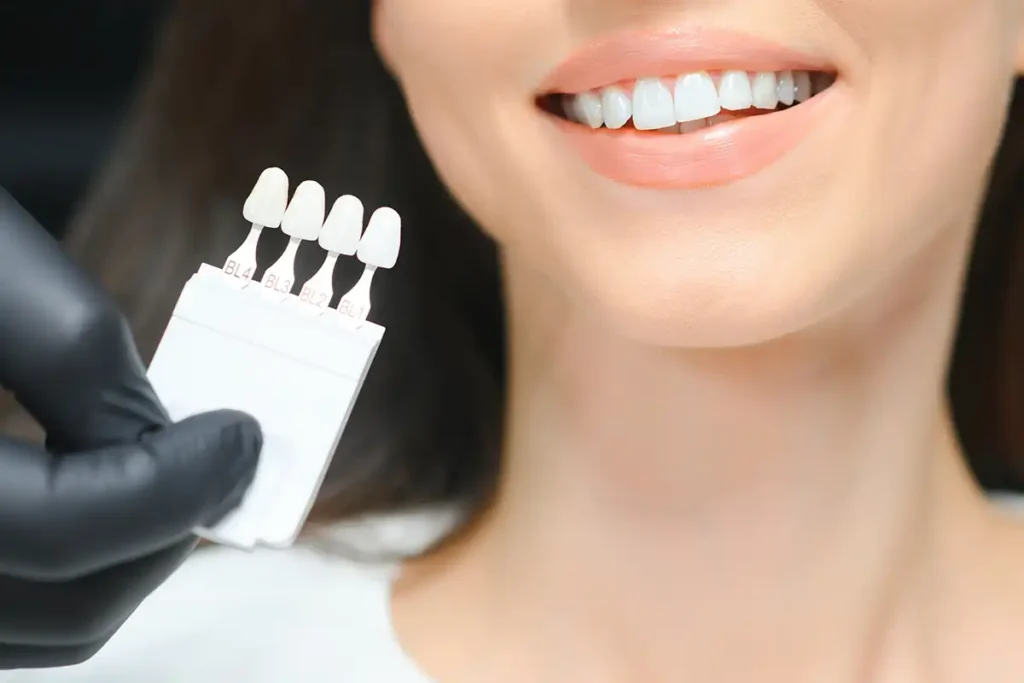 Porcelain veneers treatment by a cosmetic dentist